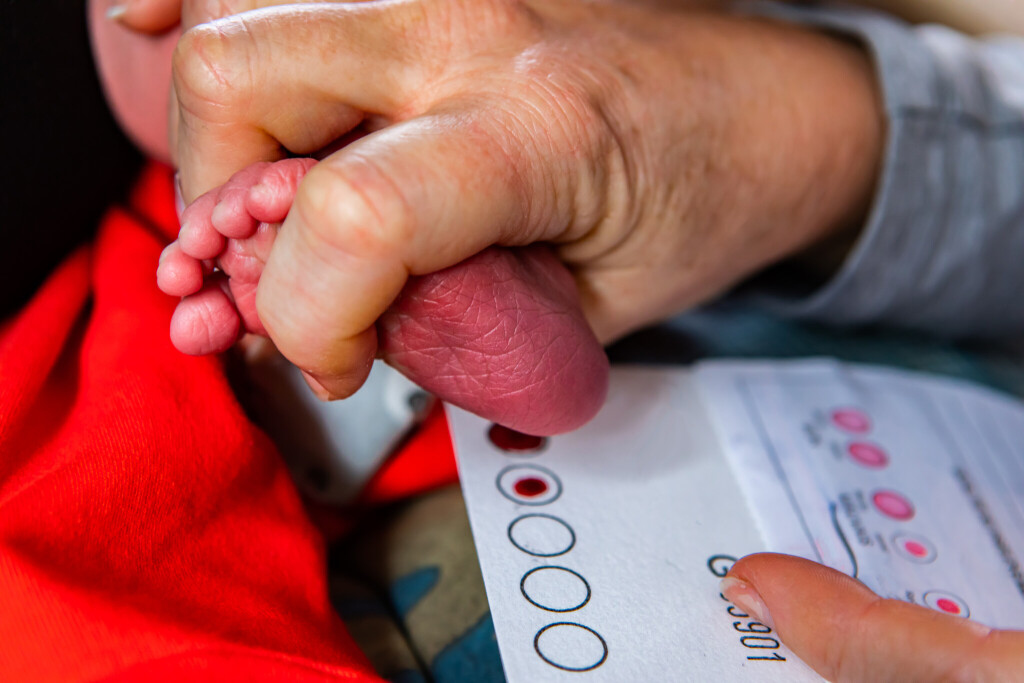 Beim Gesundheitsscreening für Neugeborene wird beim Fersenbluttest ein Tropfen aus dem Fuß des Säuglings gedrückt, um ihn zu analysieren.